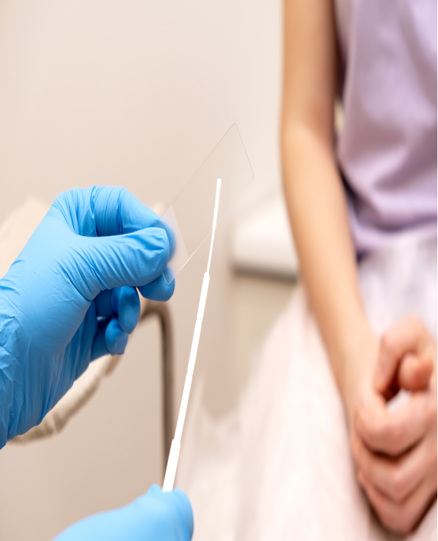 La prueba de colposcopia es una herramienta para detección temprana breve y sin dolor La prueba de colposcopia es una herramienta para detección temprana breve y sin dolor